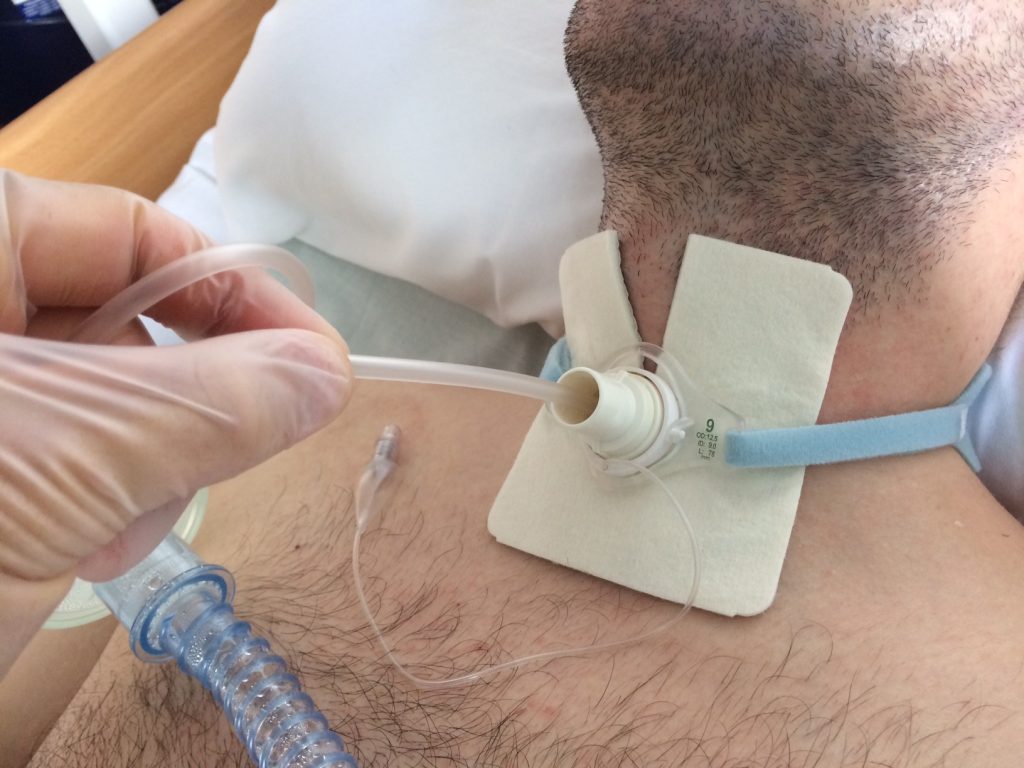 A Roma gli OSS vengono "abilitati" a pratiche infermieristiche invasive