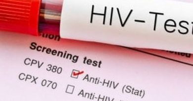 COVID19 e HIV: nessun collegamento terapeutico tra le due "Pandemie gemelle", né per contagi né per conseguenze. Test in diminuzione, ma aumenta la telemedicina