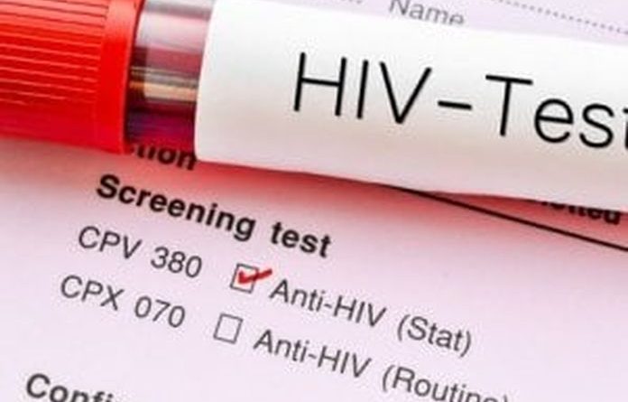 COVID19 e HIV: nessun collegamento terapeutico tra le due "Pandemie gemelle", né per contagi né per conseguenze. Test in diminuzione, ma aumenta la telemedicina