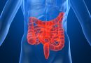 Malattia di Crohn e Colite Ulcerosa, pronta una nuova somministrazione sottocutanea. Terapie più semplici per i pazienti e meno pressione sugl