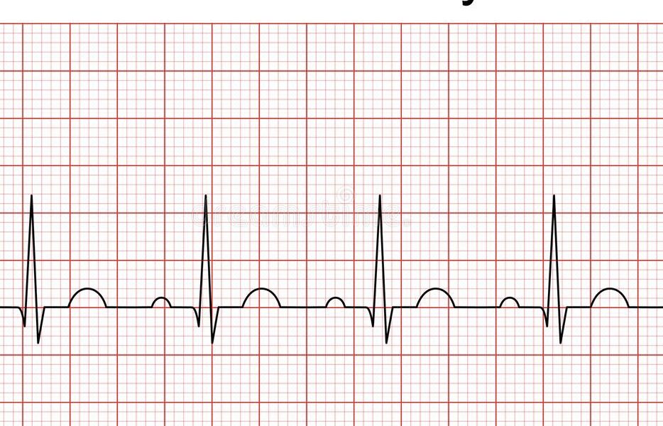 Prime linee guida cardiologi per diagnosi  con holter ed ECG più sicure 