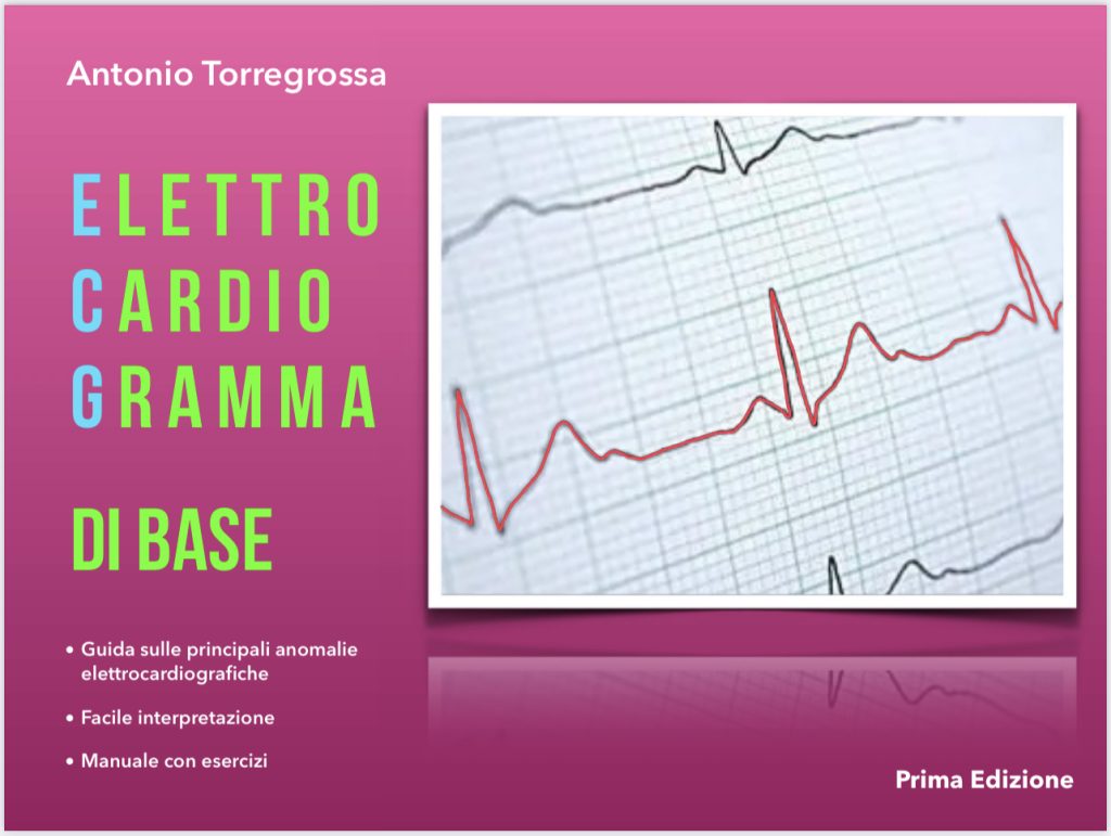 Scarica l’ebook "Elettrocardiogramma Di Base" di Antonio Torregrossa